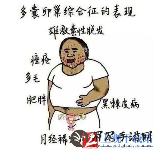 综合一与综合二图片区别是什么