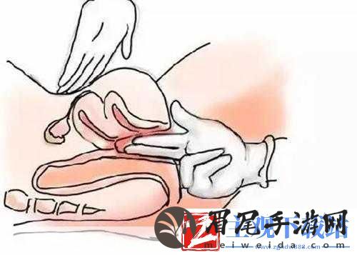 如何知道下面松紧度如何判断松紧度的标准与方法