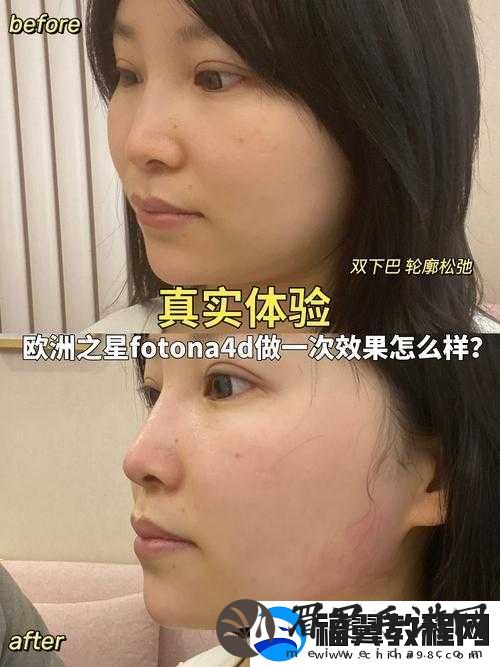 欧洲之星-4D-多久做一次合适：科学频率探讨